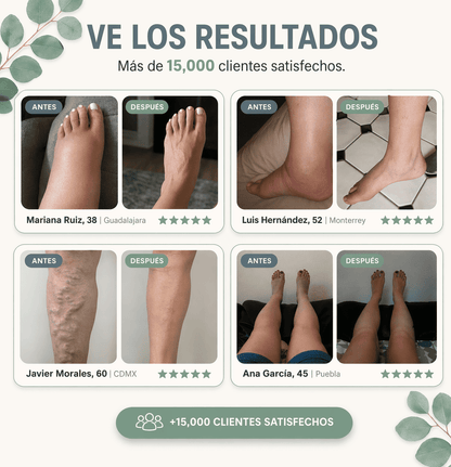 Relvia™ Miracle Balm - Piernas Ligeras